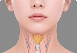 디자인 모습