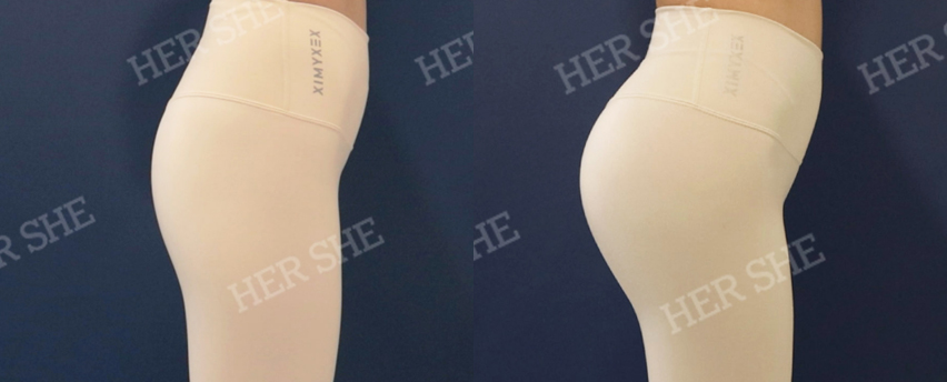 BEFORE & AFTER