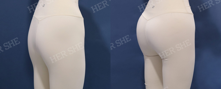 BEFORE & AFTER