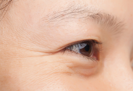 各部位皱纹改善